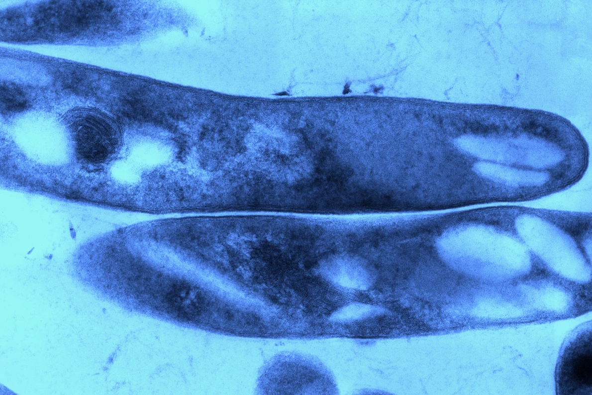 Mycobacterium tuberculosis